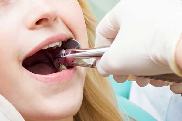 Implant Dentistry