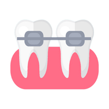 smile designing